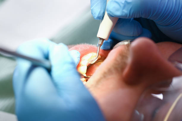 Best Tooth Pain Emergency Relief  in Lan, MI