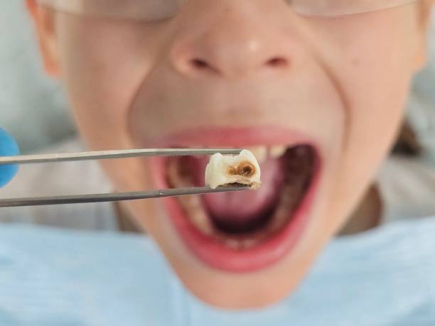 Best Tooth Pain Emergency Relief  in Lan, MI