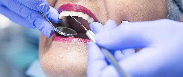 Best Emergency Tooth Extraction  in Lan, MI